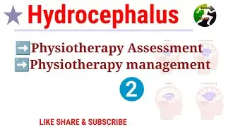 Hydrocephalus PT Assessment and PT Management |  case management part-2