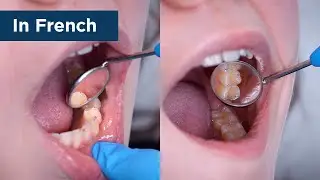 (FR) Accufilm Product Insight by Dr. Millaray Santana Lindblom