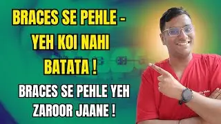 Dr Rudra| Braces Lagwane Se Pehle – Yeh Koi Nahi Batata! ब्रेसेस लगवाने से पहले – यह कोई नहीं बताता!