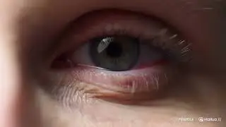 The Human Eye! Tears of Emotion! #eyes #eye #tears