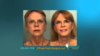 El Paso Cosmetic Surgery Dr. Ozan Sozer - Fat Grafting