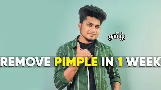 HOW TO REMOVE PIMPLE PERMANENTLY  | IN TAMIL | SARAN LIFESTYLE
