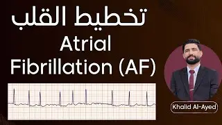تخطيط القلب ECG :: الرجفان الأذيني Atrial fibrillation (AF) | خالد العايد