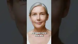 Botox Effects once you STOP! #botox #skincare #wrinkles
