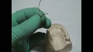 Elaboración del Arco Vestibular