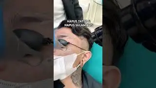 HAPUS TATTO & HAPUS SULAM ALIS #sulamalisrosidi