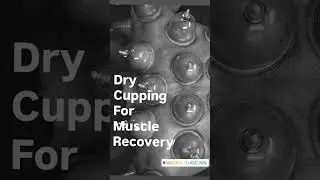 Dry Cupping for Fast Muscle Recovery 💪🩸Pain Relief | Better Blood Flow | Faster Healing #hijama