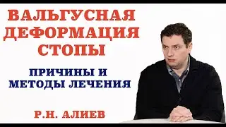 Вальгусная деформация стопы. Причины и методы лечения.
