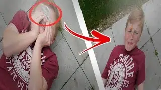 9,9999 MPH FIDGET SPINNER VS HEAD! *BLOOD WARNING*