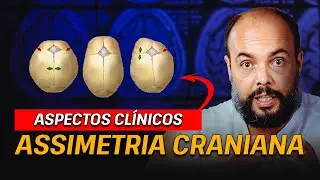 Assimetria Craniana: Aspectos Clínicos #EP3