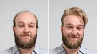 Trendy Hairstyle For Spring 2019 | Hair Replacement Transformation | Hairsystems Heydecke