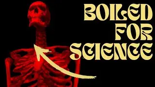 The DARK Fate of the IRISH GIANT | A Medical Spectacle