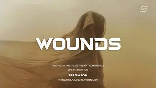 Emotional Choir Type Beat &ldquo;WOUNDS&rdquo; | Omah Lay x Burna Boy Afrobeat Type Beat