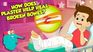 Broken Bone Healing Process | How Plaster Helps in Fracture? | Bone Fractures | Dr. Binocs Show