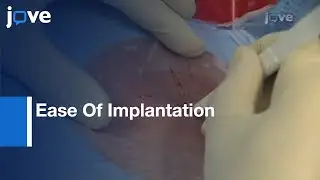 New Single Chamber Implantable Defibrillator With Atrial Sensing l Protocol Preview