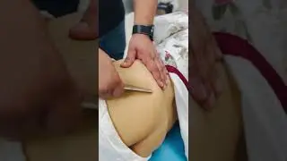 Hip pain treatment #ytshorts #shortsfeed