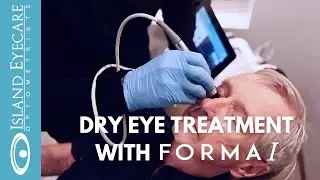 Behind the Scenes | Step by Step Dry Eye Treatment with Forma I at Island Eyecare