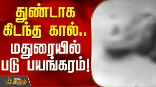துண்டாக கிடந்த கால்.. மதுரையில் படு பயங்கரம்! | Madurai News | Police