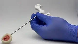n-IBS&reg; Injectable Bone Substitute &ndash; Disc Space Filling in Spine Surgery