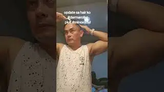 Numinipis na buhok? Kaya &lsquo;yan! 👊