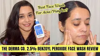 The Derma Co. Benzoyl Peroxide Face Wash Review | Best Face Wash For Pimples? Just another girl