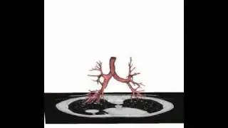 Functional imaging in the respiratory field