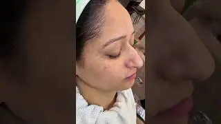 FT PRO PROFESSIONAL Korean class facial kit 6ni1