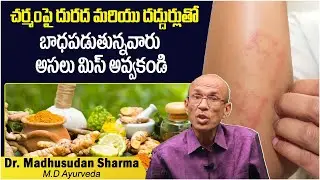 దురద, దద్దుర్లు | Ayurvedic Medicine For Skin Allergies In Telugu | Urticaria | Socialpost Health