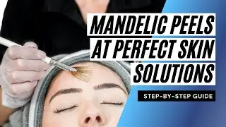 Mandelic Peels at Perfect Skin Solutions: A Step-By-Step Guide