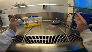 6. Detaching cells using a scraper or trypsine