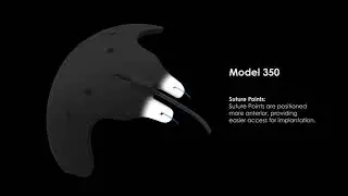 Ahmed ClearPath&reg; Model 350 Animation
