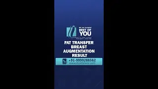 Breast Enlargement with Fat Transfer Results, Breast Augmentation Before & After Results in Delhi