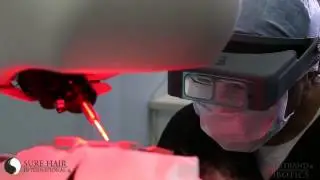 ARTAS Hair Transplant Doctor - Toronto, Ottawa, Hamilton, Guelph, Kitchener, Waterloo