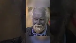 Вот до чего доводит самолечение