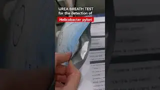 Urea breath test for Helicobacter pylori detection #laboratory #mls #cls #medtechstudent #mlt