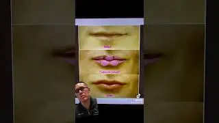 Dallas Facial Plastic Surgeon Dr Sam Lam talks about the aesthetic goals of natural lip enhancement.