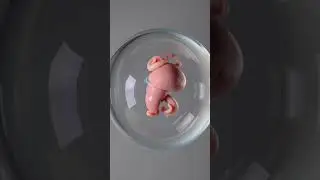 5-Week Embryo Development Inside the Womb | 3D Medical Animation  #anatomy #aihealth