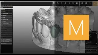 Attachments software module of Zirkonzahn.Modellier | Zirkonzahn.Software