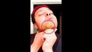 Waxing Female Beard