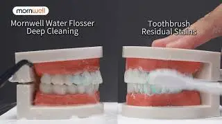 Mornwell Water Flosser Teeth Picks 4 Jets 3 Modes Portable Cordless