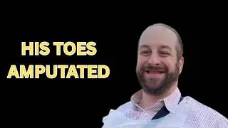 His Toes Were Amputated Because of Diabetes (Carnivore Story)