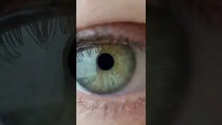 Human Eye Dilation #shorts #eyes