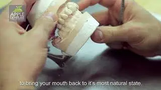 Experts in Implant Dentures - Apple Denture & Implant Solutions