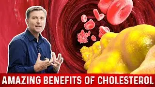 Cholesterol Function &ndash; Amazing Benefits of Cholesterol &ndash; Dr. Berg