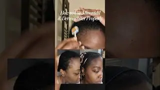 How to use Minoxidil and Dermaroller on edges #minoxidil #hairgrowthtips #hairlosstips