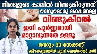 വിണ്ടുകീറൽ കാരണം ബുദ്ധിമുട്ടുന്നവരാണോ നിങ്ങൾ |രാത്രി കിടക്കുന്നതിന് മുൻപ് ഇങ്ങനെ ചെയ്‌താൽ