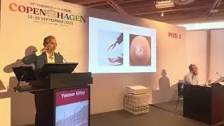 مشاركة الدكتور الرفاعي في مؤتمر ESCRS 2025 , تشخيص الساد بجهاز I TRACE