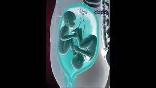 Twins struggles inside the Womb for supremacy (3D Animation)