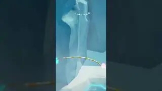 What even is happening? - Biped - Twitch Clip