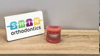What happens if you don't brush your gums during braces?
